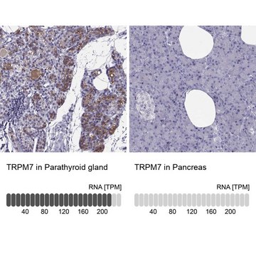 Anti-TRPM7 antibody produced in rabbit Prestige Antibodies&#174; Powered by Atlas Antibodies, affinity isolated antibody