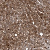 Anti-GPT antibody produced in rabbit Prestige Antibodies&#174; Powered by Atlas Antibodies, affinity isolated antibody, buffered aqueous glycerol solution, ab2