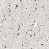 Anti-ZFC3H1 antibody produced in rabbit Prestige Antibodies&#174; Powered by Atlas Antibodies, affinity isolated antibody, buffered aqueous glycerol solution
