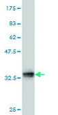 Monoclonal Anti-TCOF1 antibody produced in mouse clone 8H3, purified immunoglobulin, buffered aqueous solution