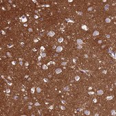 Anti-NCAM1 antibody produced in rabbit Prestige Antibodies&#174; Powered by Atlas Antibodies, affinity isolated antibody, buffered aqueous glycerol solution