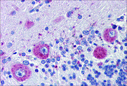 Anti-GRHL2 antibody produced in rabbit affinity isolated antibody