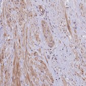 Anti-UBE3A antibody produced in rabbit affinity isolated antibody, buffered aqueous glycerol solution