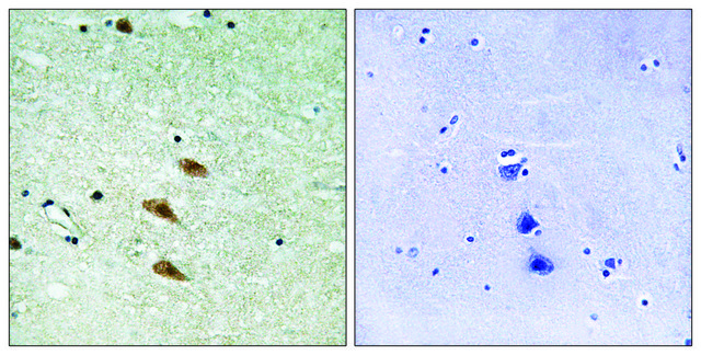 Anti-TOP2A, antibody produced in rabbit affinity isolated antibody