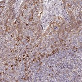 Anti-APOLD1 antibody produced in rabbit Prestige Antibodies&#174; Powered by Atlas Antibodies, affinity isolated antibody, buffered aqueous glycerol solution