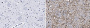 Anti-Tyrosine Hydroxylase Antibody, clone 3M12, ZooMAb&#174; Rabbit Monoclonal recombinant, expressed in HEK 293 cells