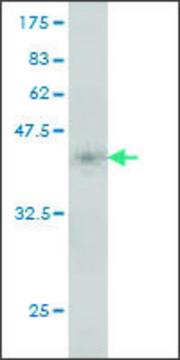 Monoclonal Anti-MTRR antibody produced in mouse clone 1G7, purified immunoglobulin, buffered aqueous solution