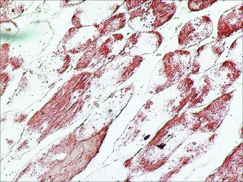 Anti-UCP-3 antibody produced in rabbit affinity isolated antibody, buffered aqueous solution