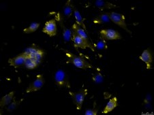 OSUMMER.8 Mouse NRAS-Mutant Melanoma Cell Line