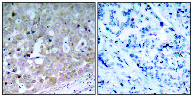 Anti-VEGFR2 antibody produced in rabbit affinity isolated antibody