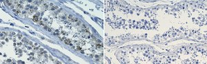 Anti-DEPDC5 Antibody, clone 1G17 ZooMAb&#174; Rabbit Monoclonal recombinant, expressed in HEK 293 cells