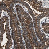 Anti-CAPN1 antibody produced in rabbit Prestige Antibodies&#174; Powered by Atlas Antibodies, affinity isolated antibody, buffered aqueous glycerol solution