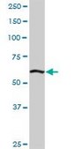 Anti-ELAC2 antibody produced in rabbit purified immunoglobulin, buffered aqueous solution