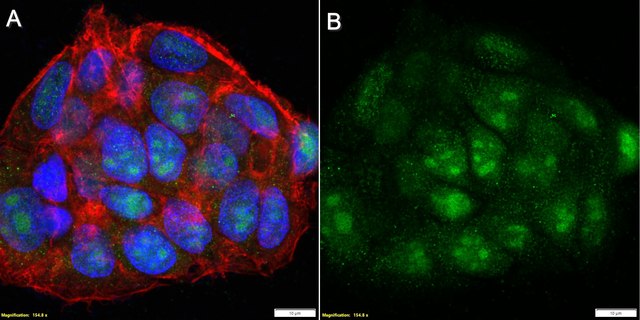 Anti-HIF-2&#945;/EPAS1 Antibody, clone 2L21 ZooMAb&#174; Rabbit Monoclonal recombinant, expressed in HEK 293 cells