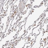 Anti-TBX5 antibody produced in rabbit Prestige Antibodies&#174; Powered by Atlas Antibodies, affinity isolated antibody, buffered aqueous glycerol solution