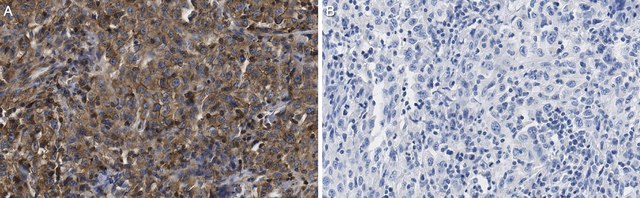 Anti-Interferon-&#945; Antibody purified antibody, clone ST126, from mouse