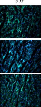 Anti-Choline Acetyltransferase Antibody serum, Chemicon&#174;