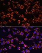 Anti-IL18 antibody produced in rabbit