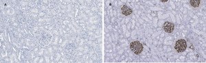 Anti-Nestin Antibody, clone 8B8, ZooMAb&#174; Rabbit Monoclonal recombinant, expressed in HEK 293 cells