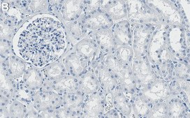 Anti-ROCK-1 Antibody, clone 3K23 ZooMAb&#174; Rabbit Monoclonal recombinant, expressed in HEK 293 cells
