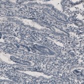 Anti-CT83 antibody produced in rabbit Prestige Antibodies&#174; Powered by Atlas Antibodies, affinity isolated antibody, buffered aqueous glycerol solution
