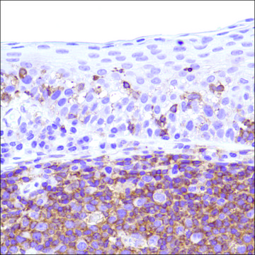 Anti-CSF-1R antibody, Rabbit monoclonal clone SP211, recombinant, expressed in proprietary host, affinity isolated antibody