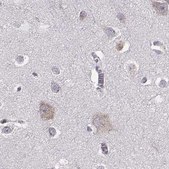 Anti-BFSP2 antibody produced in rabbit Prestige Antibodies&#174; Powered by Atlas Antibodies, affinity isolated antibody