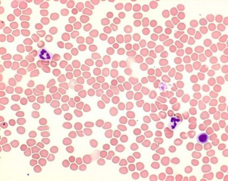 Giemsa&#8242;s azur eosin methylene blue solution for microscopy