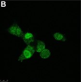 Anti-SNAI1 Antibody, clone 1F16 ZooMAb&#174; Rabbit Monoclonal recombinant, expressed in HEK 293 cells