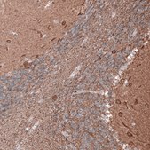 Monoclonal Anti-TUBB3 antibody produced in mouse Prestige Antibodies&#174; Powered by Atlas Antibodies, clone CL5814, purified immunoglobulin, buffered aqueous glycerol solution