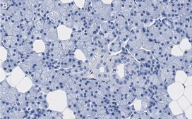 Anti-Aquaporin 5 Antibody, clone 3H17 ZooMAb&#174; Rabbit Monoclonal recombinant, expressed in HEK 293 cells