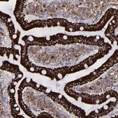 Anti-MAOB antibody produced in rabbit Prestige Antibodies&#174; Powered by Atlas Antibodies, affinity isolated antibody, buffered aqueous glycerol solution