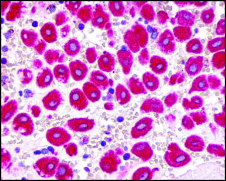 Anti-CXCR2 antibody produced in rabbit affinity isolated antibody, buffered aqueous solution