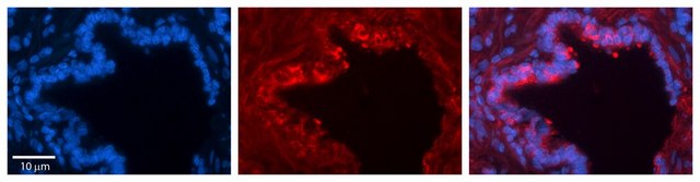 Anti-LDHA affinity isolated antibody