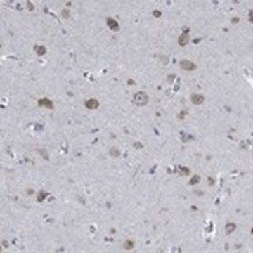 Anti-MMP24 antibody produced in rabbit Prestige Antibodies&#174; Powered by Atlas Antibodies, affinity isolated antibody, buffered aqueous glycerol solution
