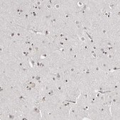 Anti-TRIM66 antibody produced in rabbit Prestige Antibodies&#174; Powered by Atlas Antibodies, affinity isolated antibody, buffered aqueous glycerol solution