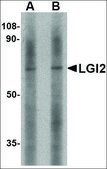 Anti-LGI2 (ab2) antibody produced in rabbit affinity isolated antibody, buffered aqueous solution