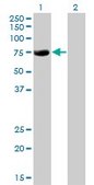 Monoclonal Anti-CBFA2T2 antibody produced in mouse clone 2C10, purified immunoglobulin, buffered aqueous solution