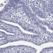 Anti-CPT1B antibody produced in rabbit Prestige Antibodies&#174; Powered by Atlas Antibodies, affinity isolated antibody, buffered aqueous glycerol solution