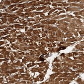 Anti-PTPRA antibody produced in rabbit Prestige Antibodies&#174; Powered by Atlas Antibodies, affinity isolated antibody, buffered aqueous glycerol solution