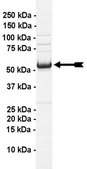 p53 Protein, 10 &#181;g Full length, recombinant human p53. N-terminal c-Myc, 6His-tagged. For use in Enzyme Assays. Functions as a substrate in ubiquitination assays.