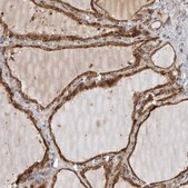 Anti-KYAT3 antibody produced in rabbit Prestige Antibodies&#174; Powered by Atlas Antibodies, affinity isolated antibody, buffered aqueous glycerol solution, Ab1