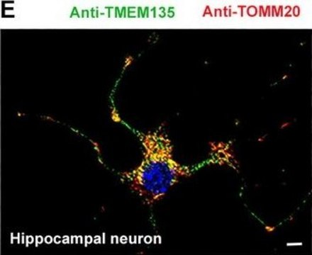 Monoclonal Anti-TOMM20 antibody produced in mouse clone 4F3, purified immunoglobulin, buffered aqueous solution