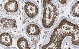 Anti-GAPDH Antibody, clone 10B13, ZooMAb&#174; Rabbit Monoclonal recombinant, expressed in HEK 293 cells