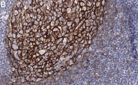 Anti-p75NTR Antibody, clone 1N3 ZooMAb&#174; Rabbit Monoclonal recombinant, expressed in HEK 293 cells