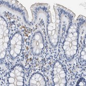 Anti-CRB3 antibody produced in rabbit Prestige Antibodies&#174; Powered by Atlas Antibodies, affinity isolated antibody, buffered aqueous glycerol solution