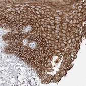 Anti-S100A14 antibody produced in rabbit Prestige Antibodies&#174; Powered by Atlas Antibodies, affinity isolated antibody, buffered aqueous glycerol solution