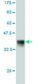 Monoclonal Anti-FZD5 antibody produced in mouse clone 6A3, purified immunoglobulin, buffered aqueous solution