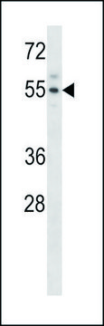 ANTI-MOUSE ACVR2A (N-TERM) antibody produced in rabbit IgG fraction of antiserum, buffered aqueous solution