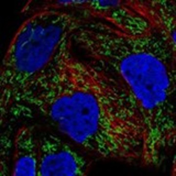 Anti-DDAH2 antibody produced in rabbit Prestige Antibodies&#174; Powered by Atlas Antibodies, affinity isolated antibody, buffered aqueous glycerol solution